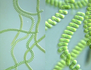 Spirulina as seen under a microscope